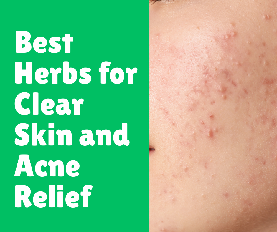 Best Herbs for Clear Skin and Acne Relief