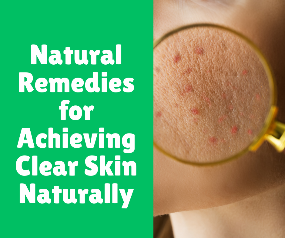Natural Remedies for Achieving Clear Skin Naturally