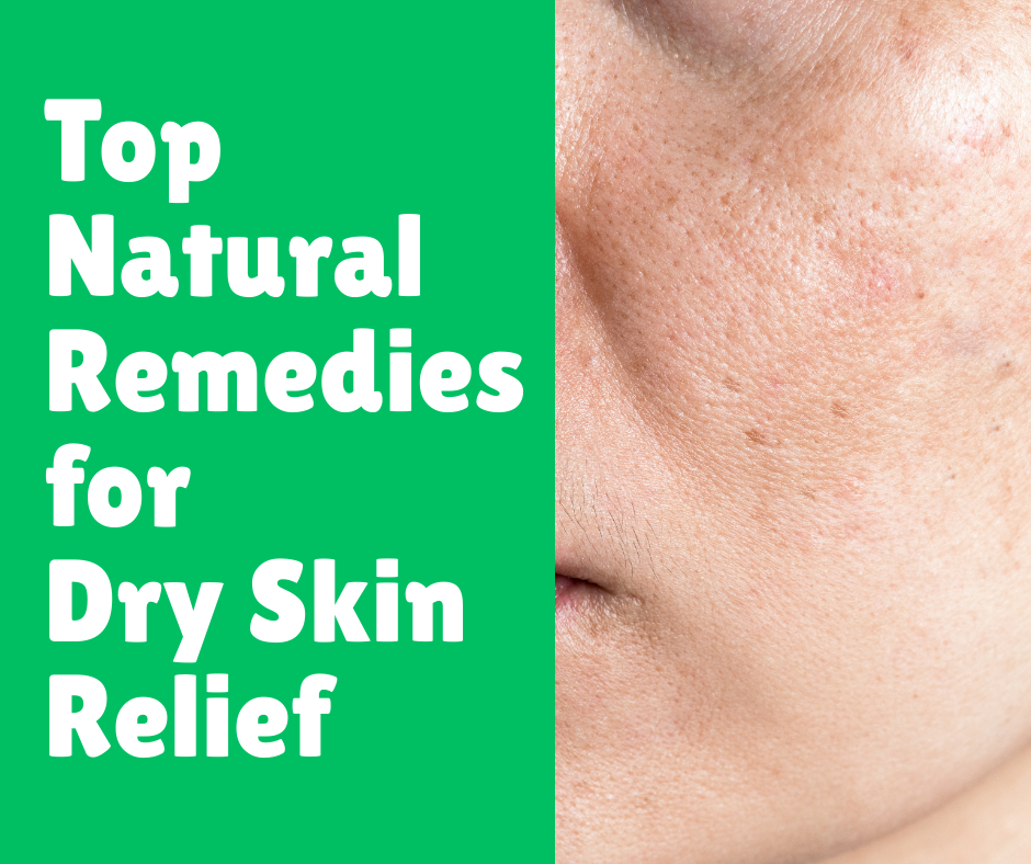 Top Natural Remedies for Dry Skin Relief