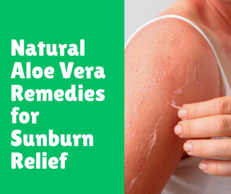 Natural Aloe Vera Remedies for Sunburn Relief