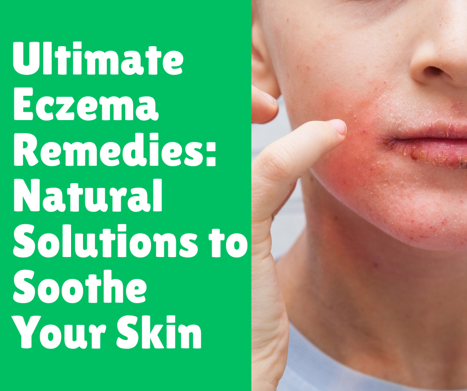 Ultimate Eczema Remedies_ Natural Solutions to Soothe Your Skin