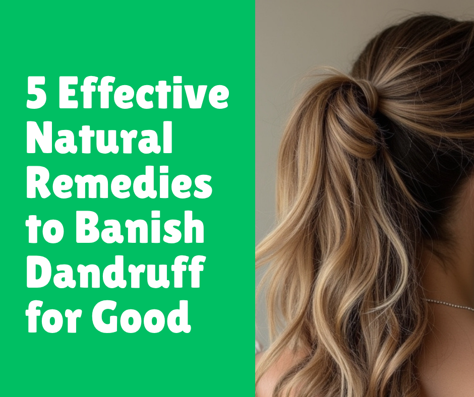 5 Effective Natural Remedies to Banish Dandruff for Good