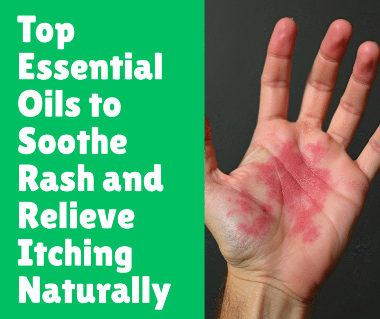 Top Essential Oils to Soothe Rash and Relieve Itching Naturally